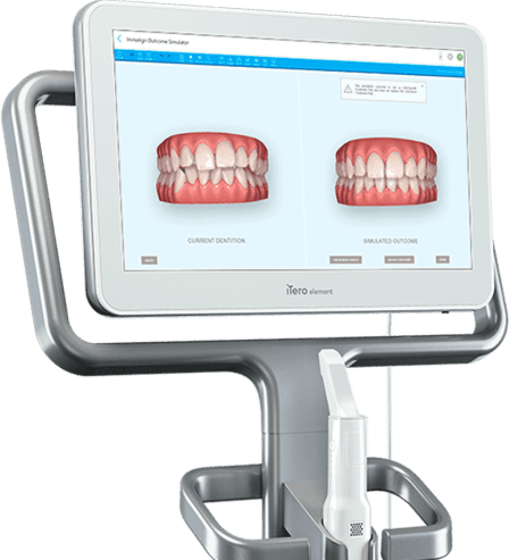 iTero Element Scanner