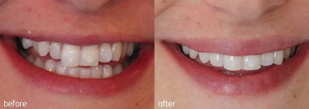 6monthsmile11
