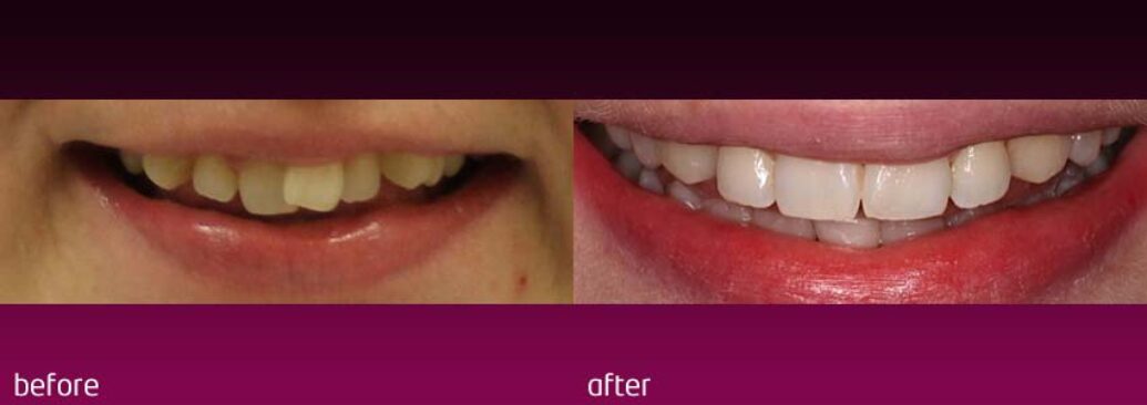 6monthsmile15