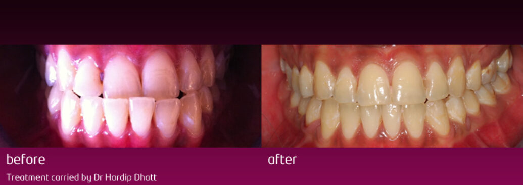 6monthsmile6