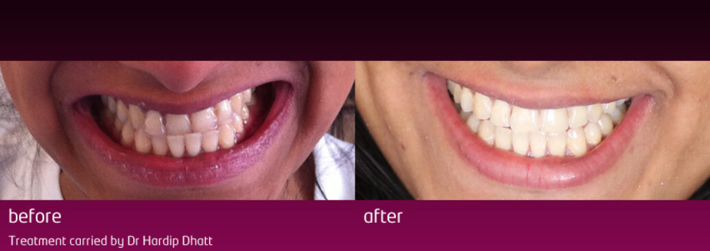 6monthsmile7