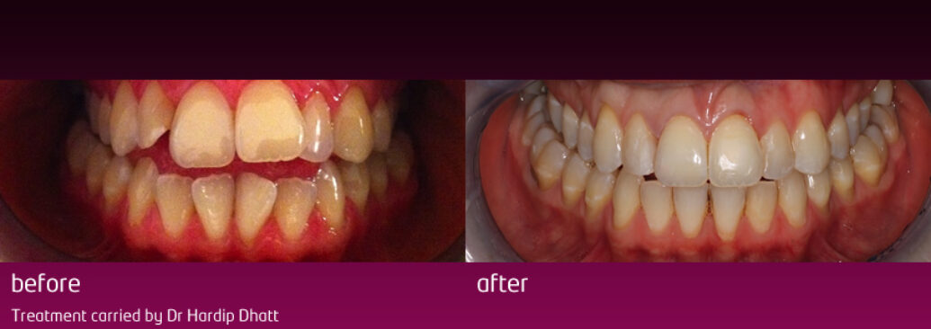 6monthsmile8