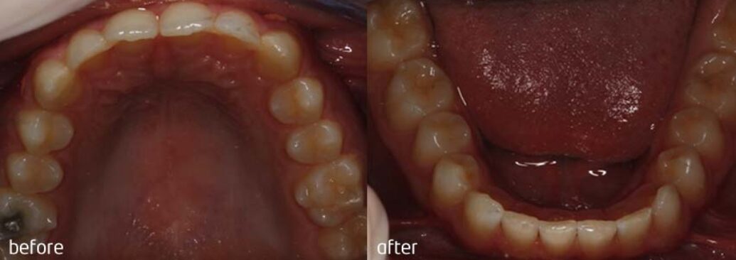 Before - Smile Studios
