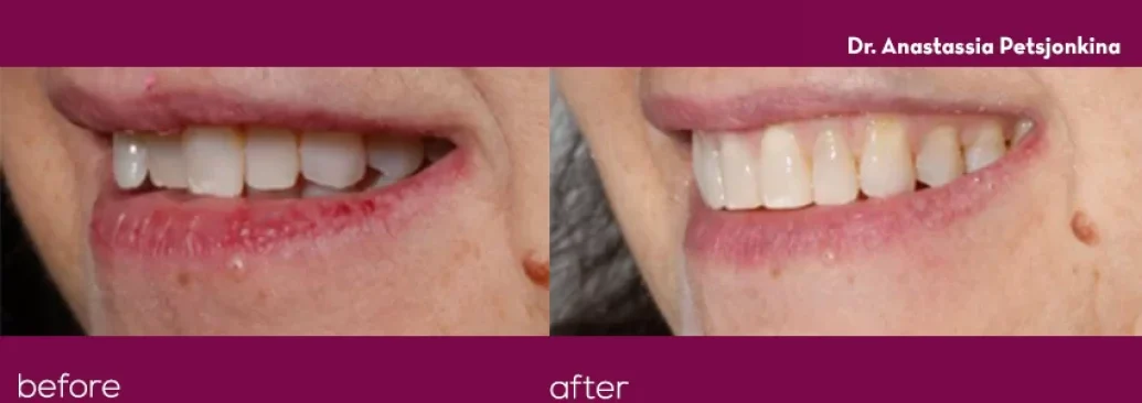 Before - Smile Studios