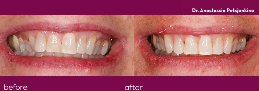 Before - Smile Studios
