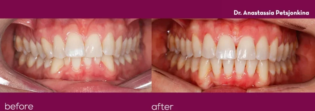 Before - Smile Studios