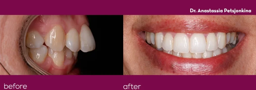 Before - Smile Studios