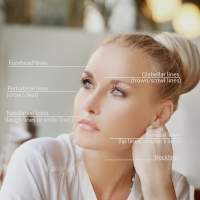 Anti-Wrinkle Injections Anti-Wrinkle Injections