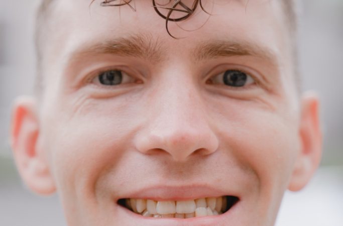 Overbite, Underbite, Crossbite & Open Bite: What’s the Difference?