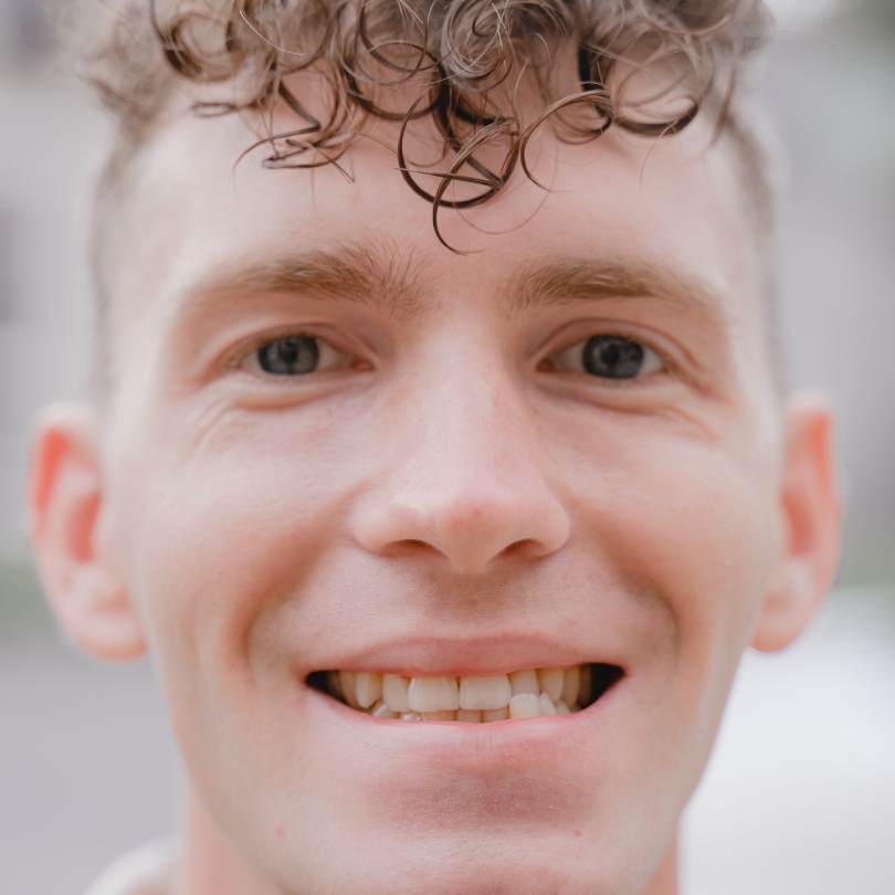 Overbite, Underbite, Crossbite & Open Bite: What’s the Difference?